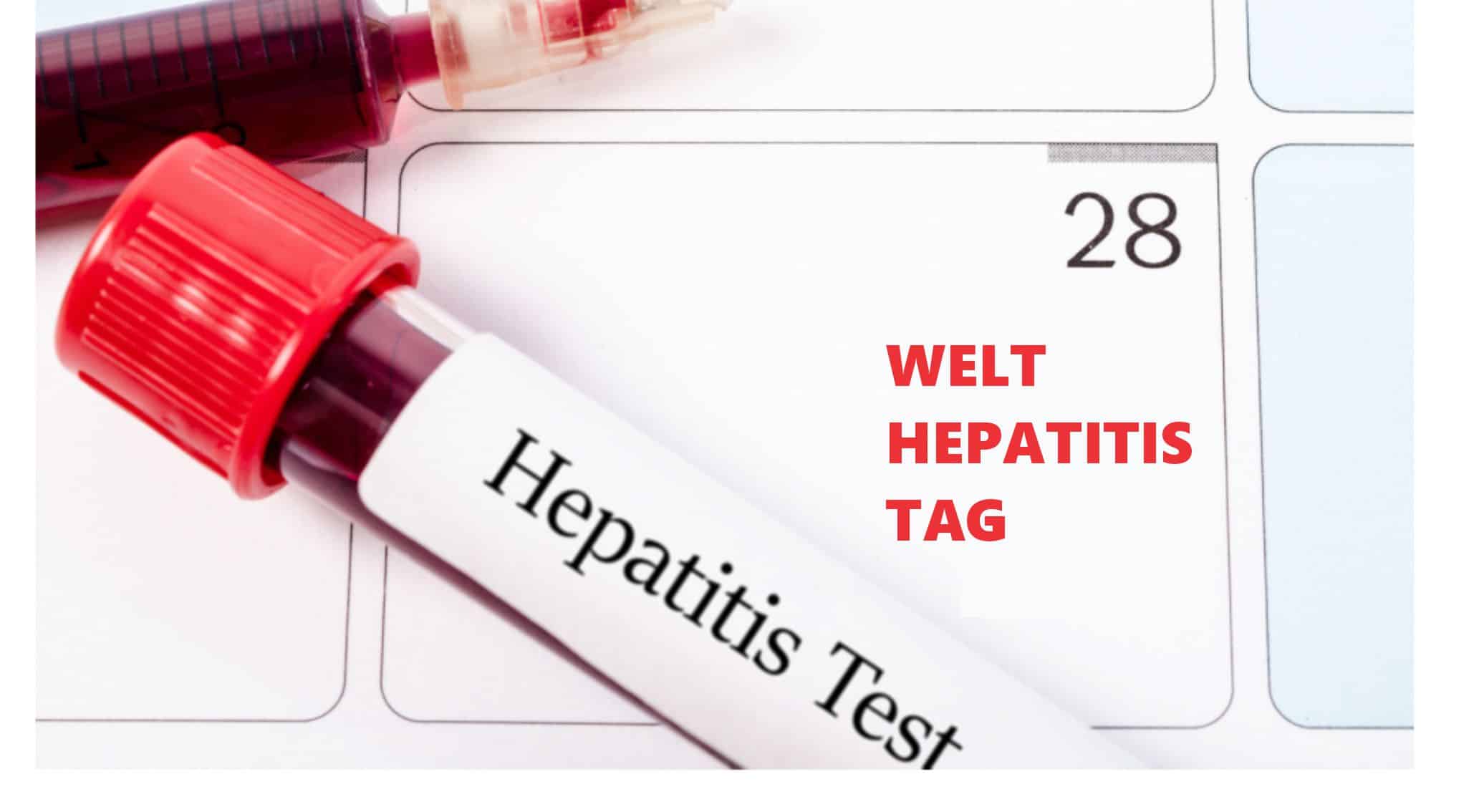 Welt-Hepatitis-Tag 2026 | Lebergesundheit im Fokus 